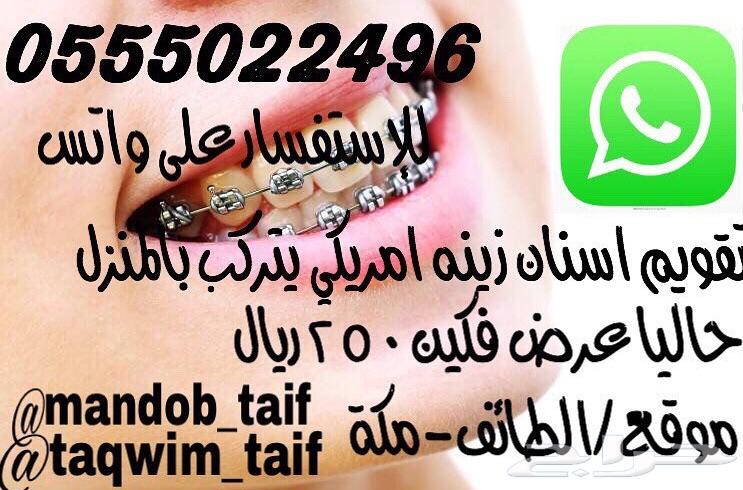 تقويم أسنان عرض خاص
