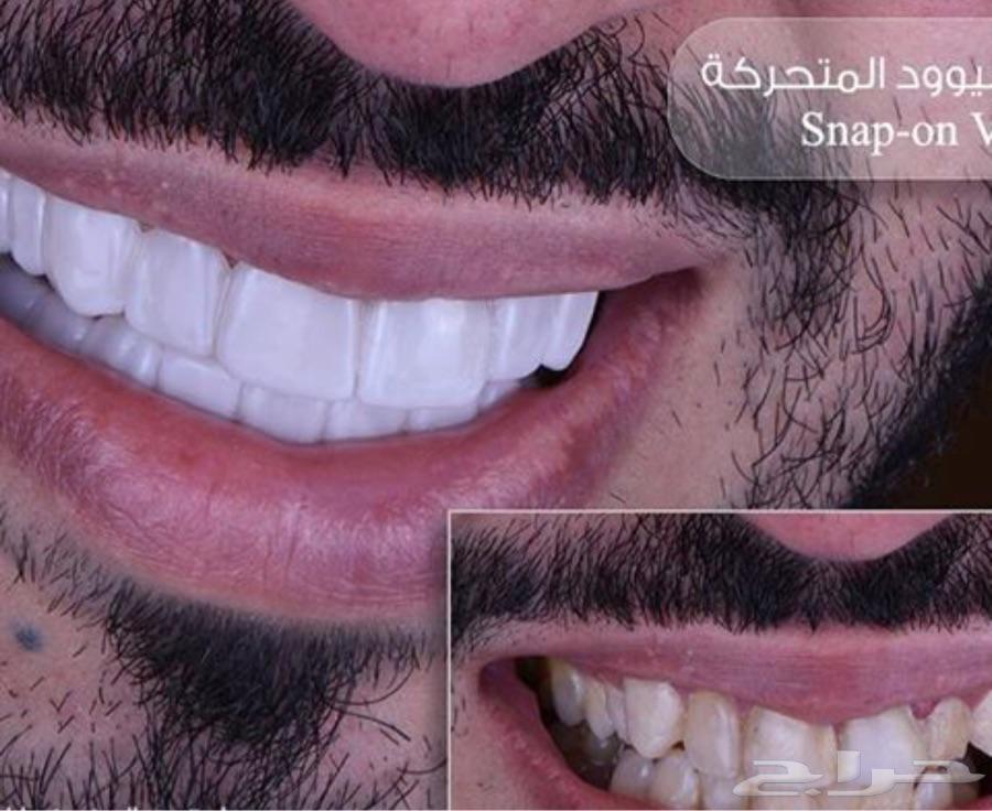 ابستامه هوليود 1000 فقط الحق العرض