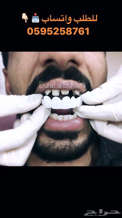 ابتسامة هوليود المتحركة
