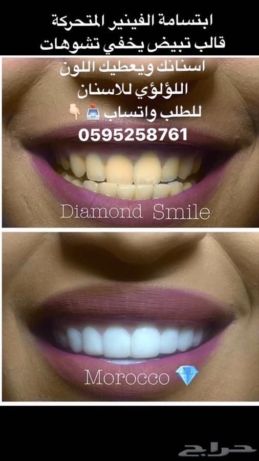 ابتسامة هوليود المتحركة