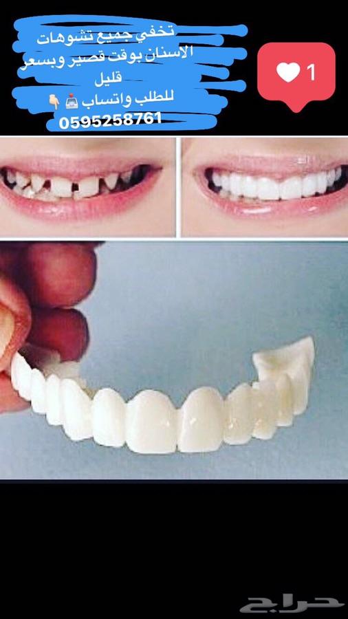 ابتسامة هوليود المتحركة