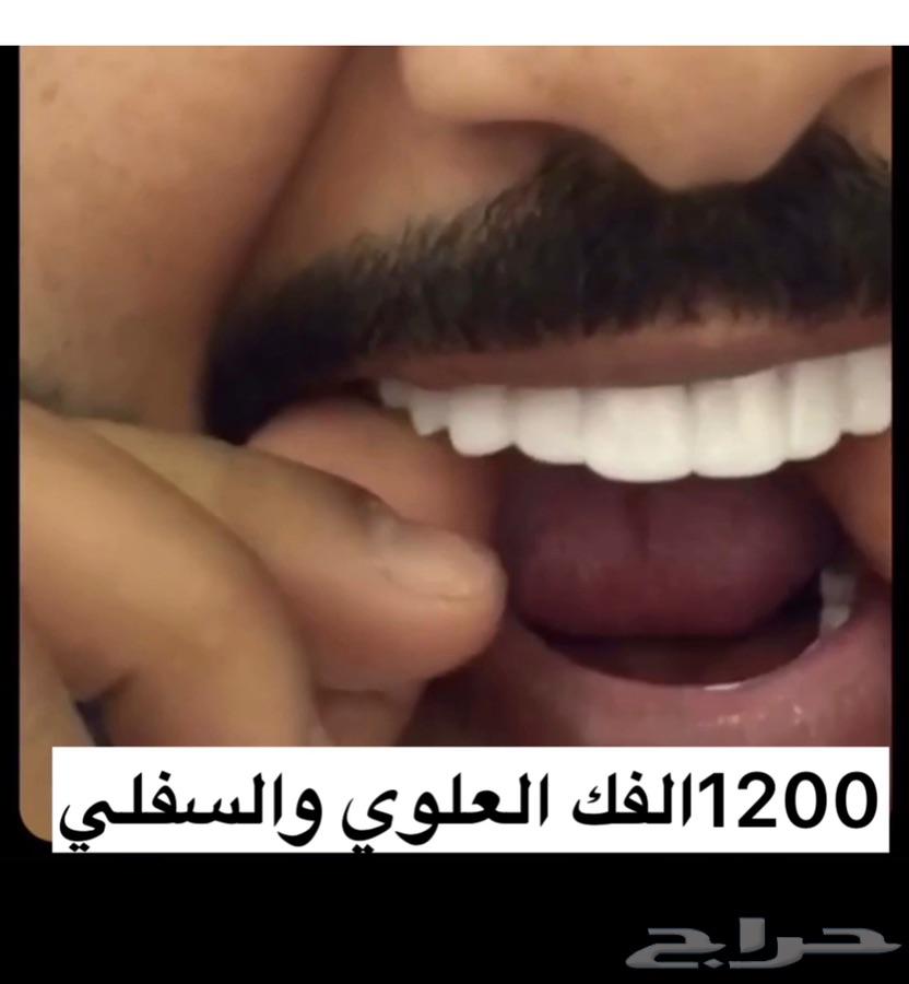 الرياض - ابتسامة الفينير