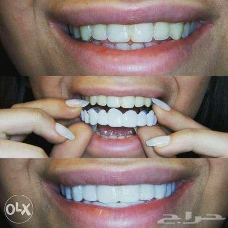 الفينير المتحرك بأسعار مناسبه لجده ومكه