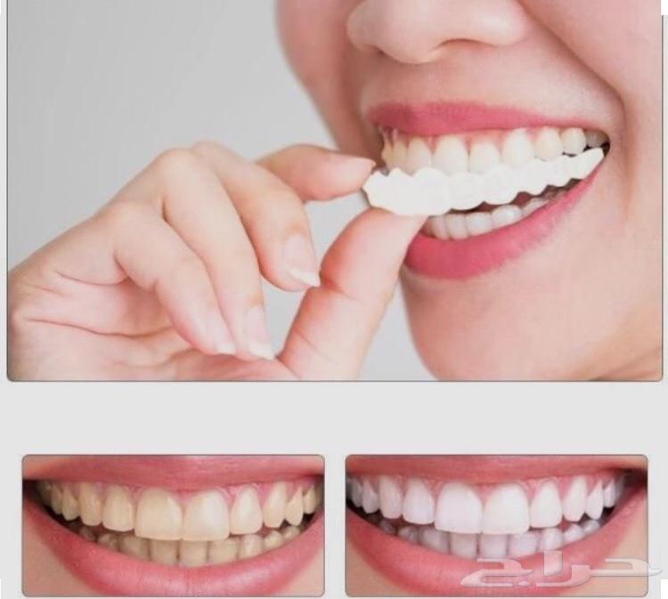 الفينير المتحرك بأسعار مناسبه لجده ومكه