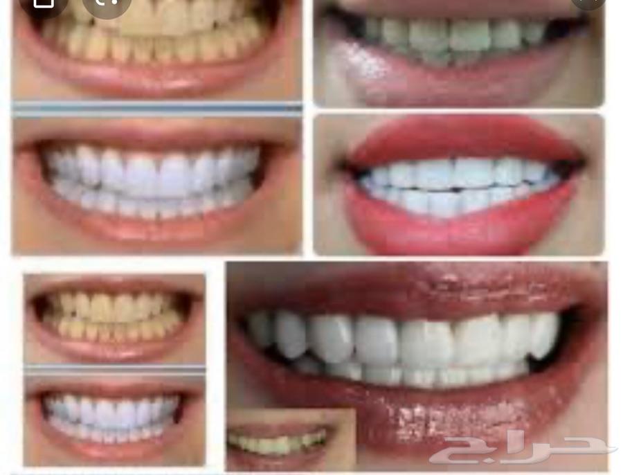 ابتسامه هوليود متحركه 1300