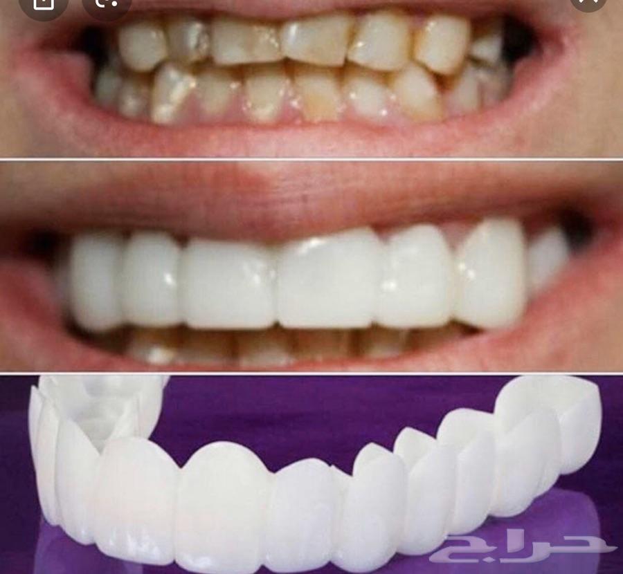 ابتسامه هوليود متحركه 1300