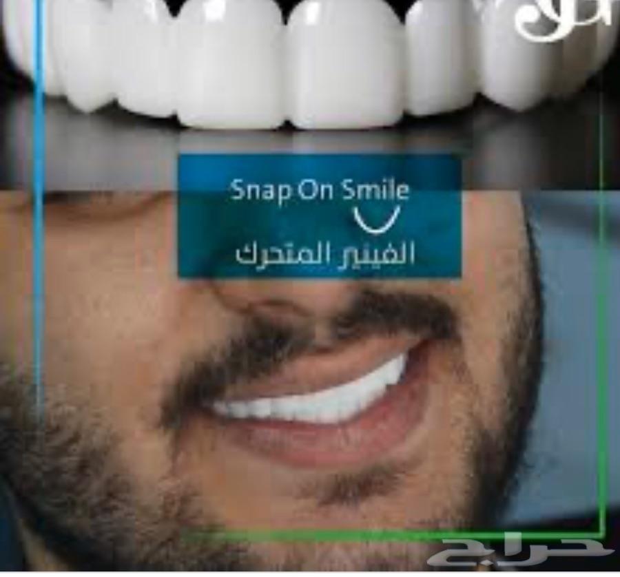 ابتسامه هوليود متحركه 1300