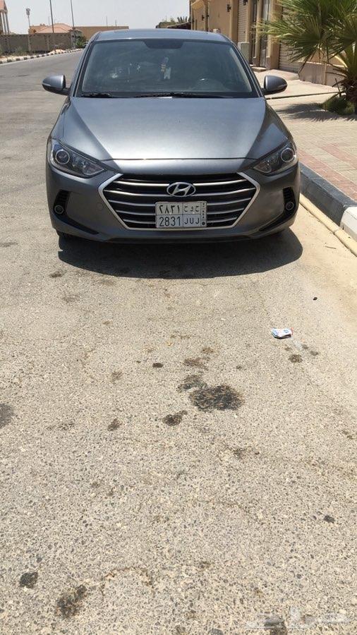 النترا للتقبيل للتنازل