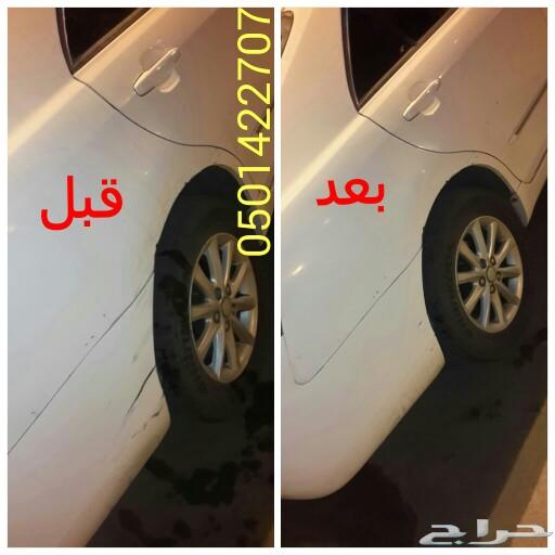 إزالة الحكات بالإسفنجة