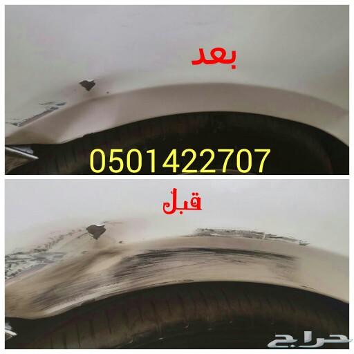 إزالة الحكات بالإسفنجة