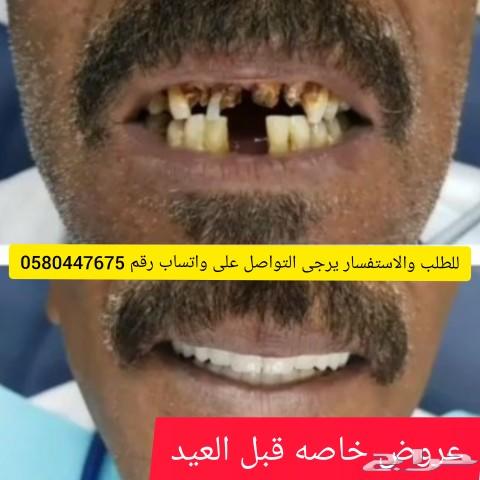 ابتسامة هوليوود المتحركه nمعنا هتحب ابتسامتك