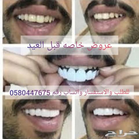ابتسامة هوليوود المتحركه nمعنا هتحب ابتسامتك