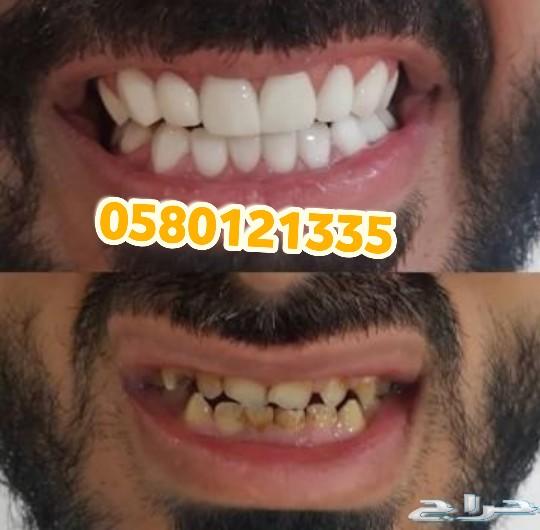 وداعا للقلق بعد اليوم ...مع ابتسامة جدة